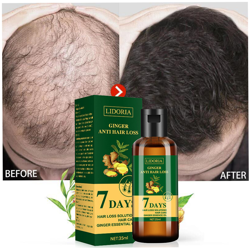 Hair Care Essence Oil Spray - Ginger Hair Growth Essential Oil Natural