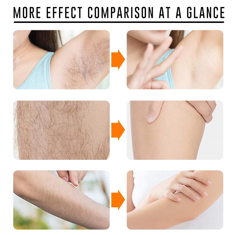 Hair Care Spray - Fast Hair Removal Spray Painless Hair
