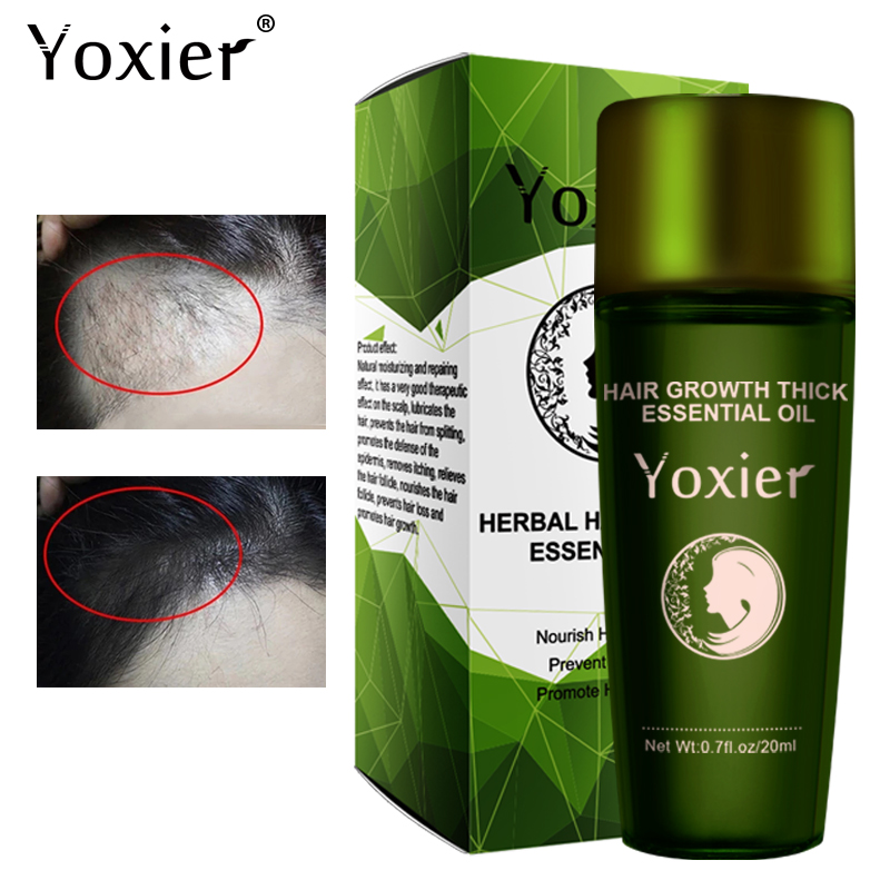 Yoxier Herbal Hair Growth Esse – Hair Care Herbal Products recenzja i cena