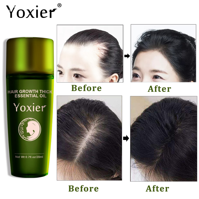 Yoxier Herbal Hair Growth Esse – Hair Care Herbal Products recenzja i cena