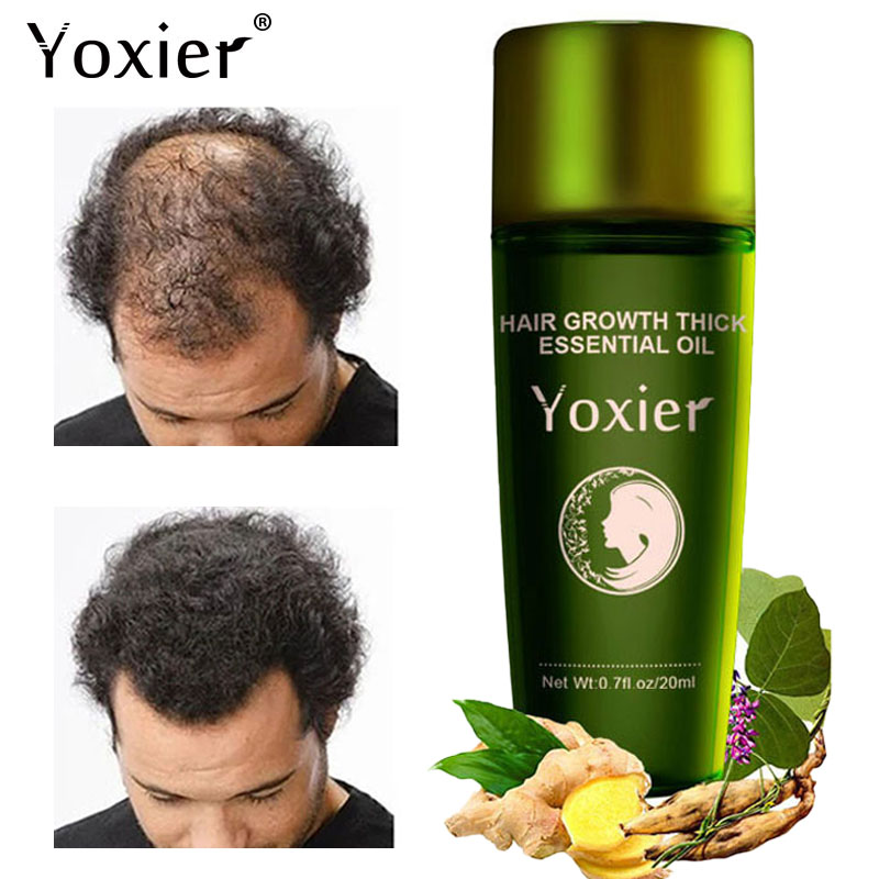 Yoxier Herbal Hair Growth Esse – Hair Care Herbal Products recenzja i cena