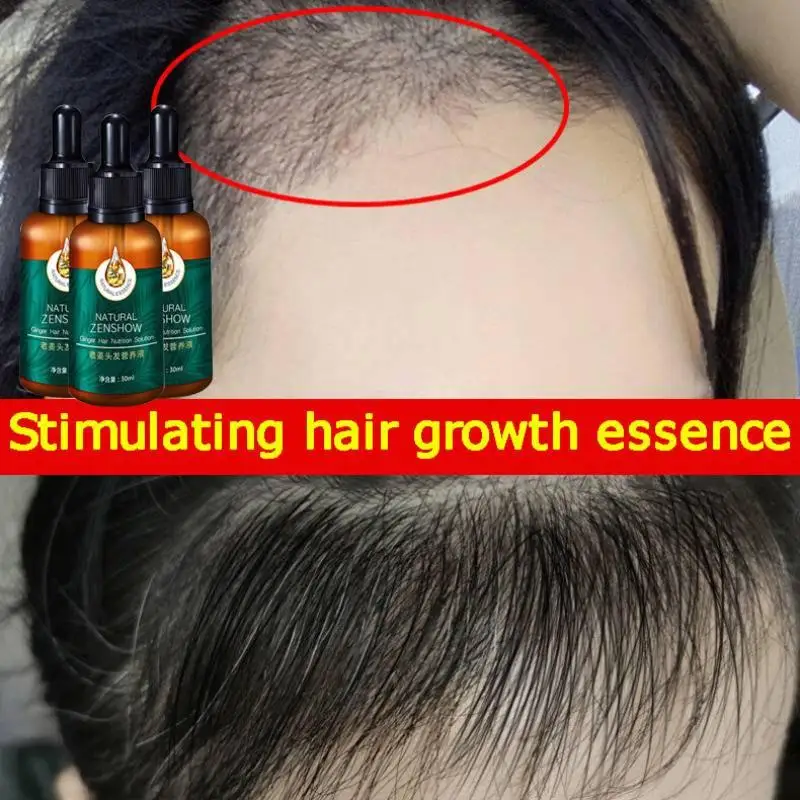 Ginger Hair Growth Essential O – Hair Care Herbal Products recenzja i cena