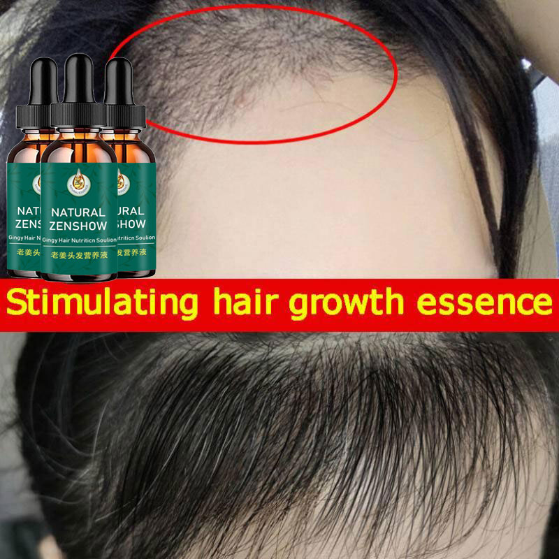 Ginger Hair Growth Essential O – Hair Care Herbal Products recenzja i cena