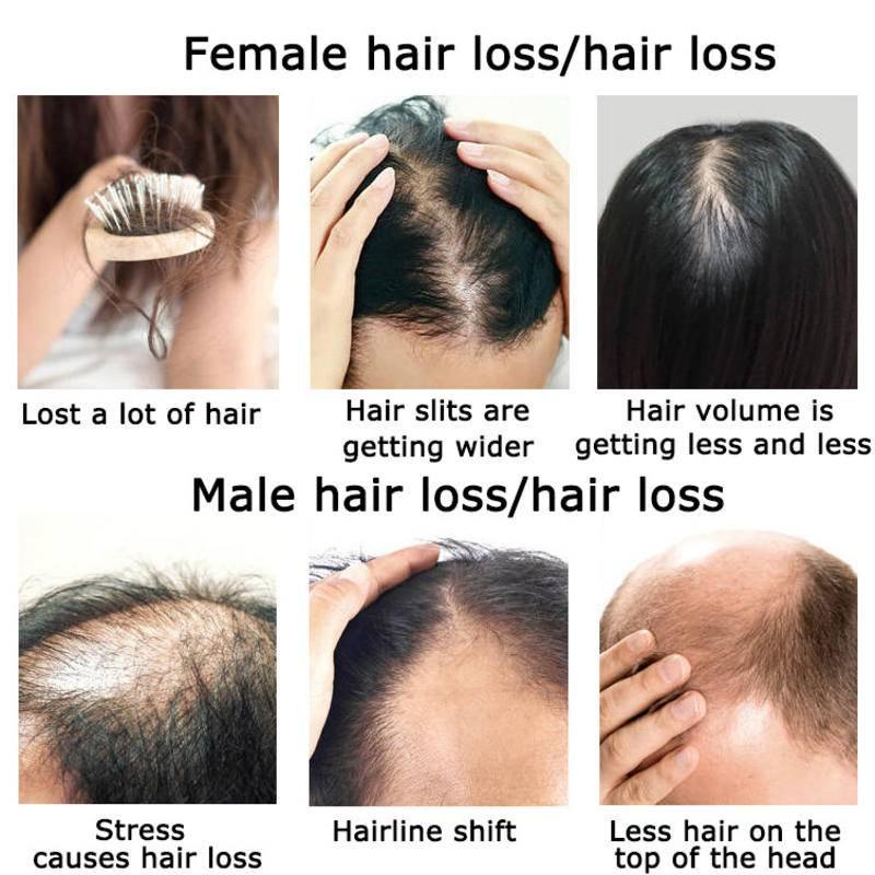 Ginger Hair Growth Essential O – Hair Care Herbal Products recenzja i cena