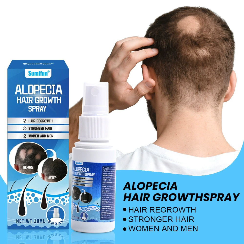 Alopecia Hair Growth Spray Sop – Hair Care Spray recenzja i cena
