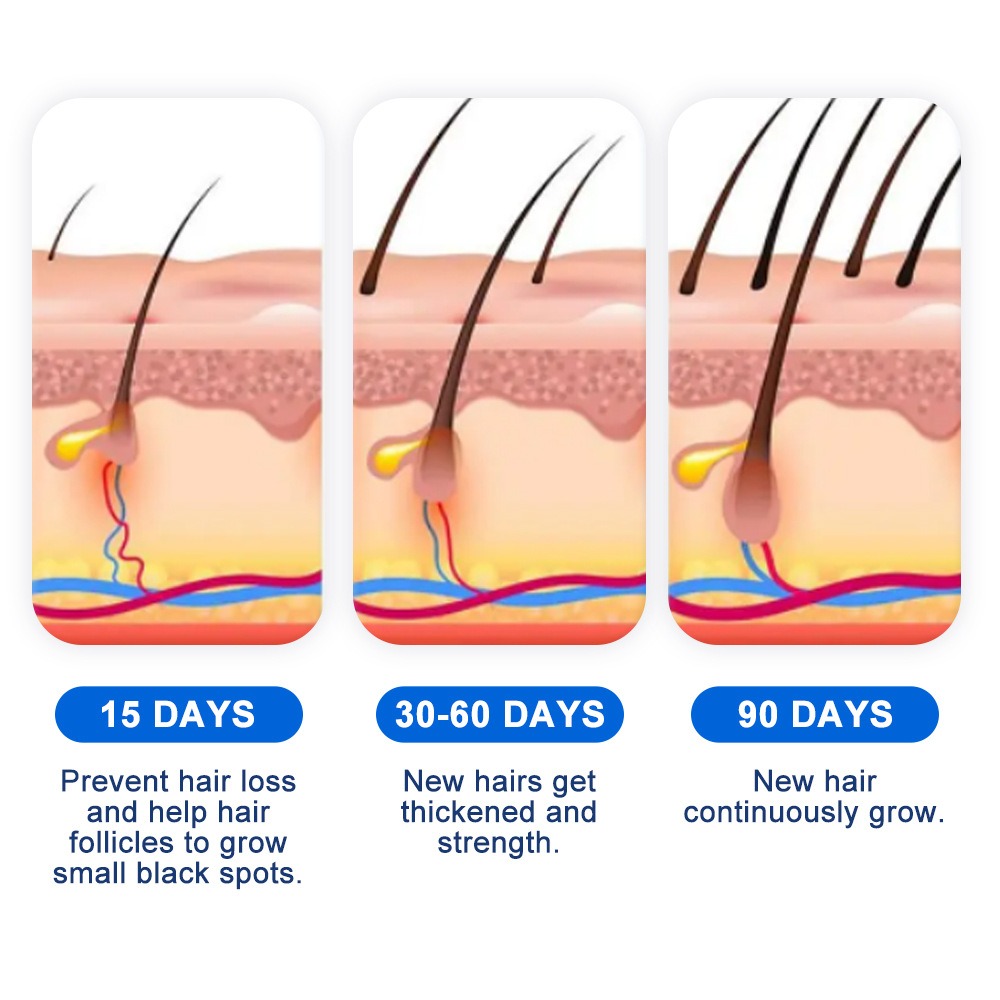 Alopecia Hair Growth Spray Sop – Hair Care Spray recenzja i cena