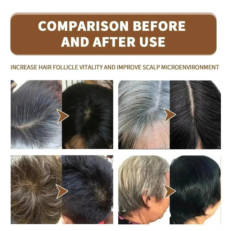 Herbal Anti-grey Treatment Hai – Hair Care Herbal Products recenzja i cena