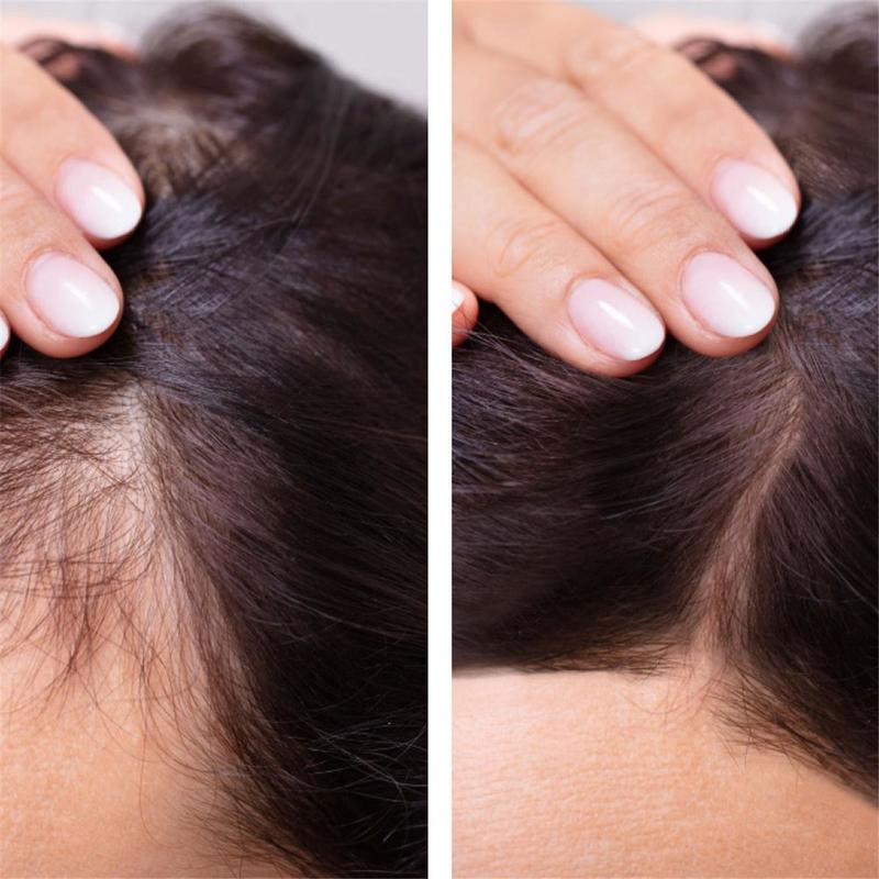 Ginger Hair Growth Essential O – Hair Care Essence Oil Spray recenzja i cena