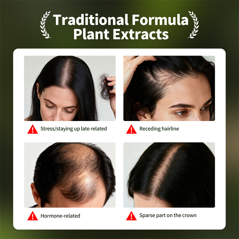 Natural Hair Growth Set Usman  – Hair Care Herbal Products recenzja i cena