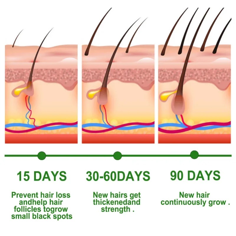 Hair Growth Serum Fast Growing – Hair Care Essence Oil Spray recenzja i cena