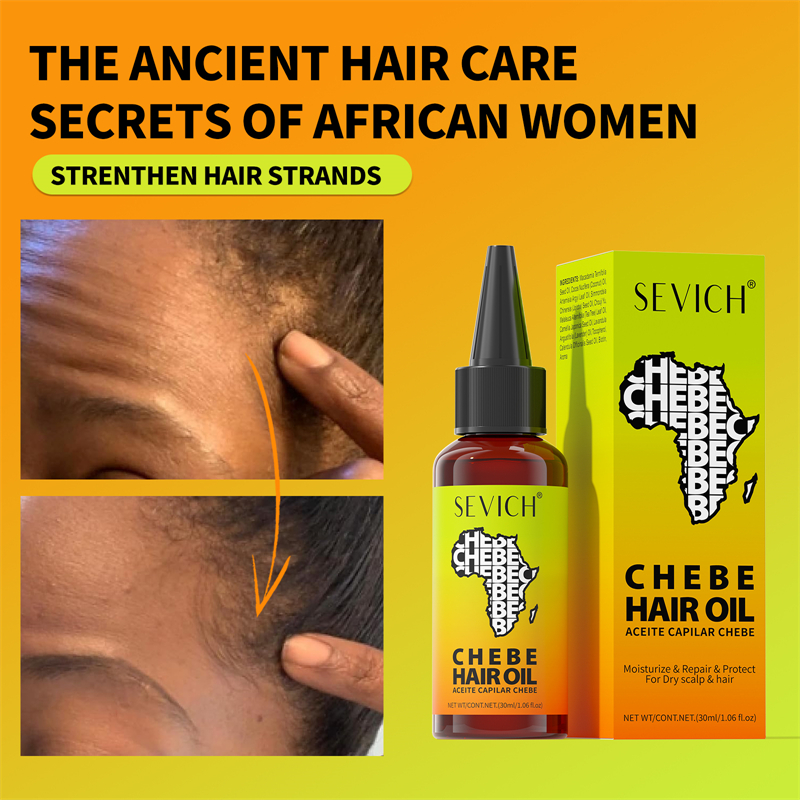Chebe Fast Hair Growth Oil Afr – Hair Care Essence Oil Spray recenzja i cena