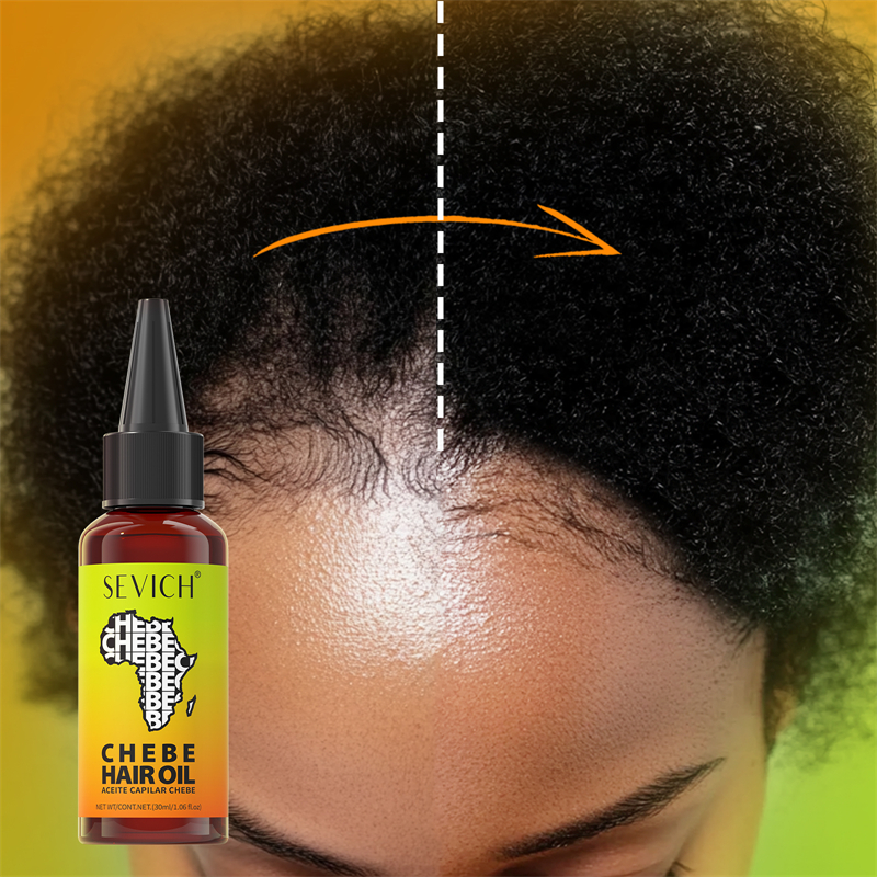 Chebe Fast Hair Growth Oil Afr – Hair Care Essence Oil Spray recenzja i cena