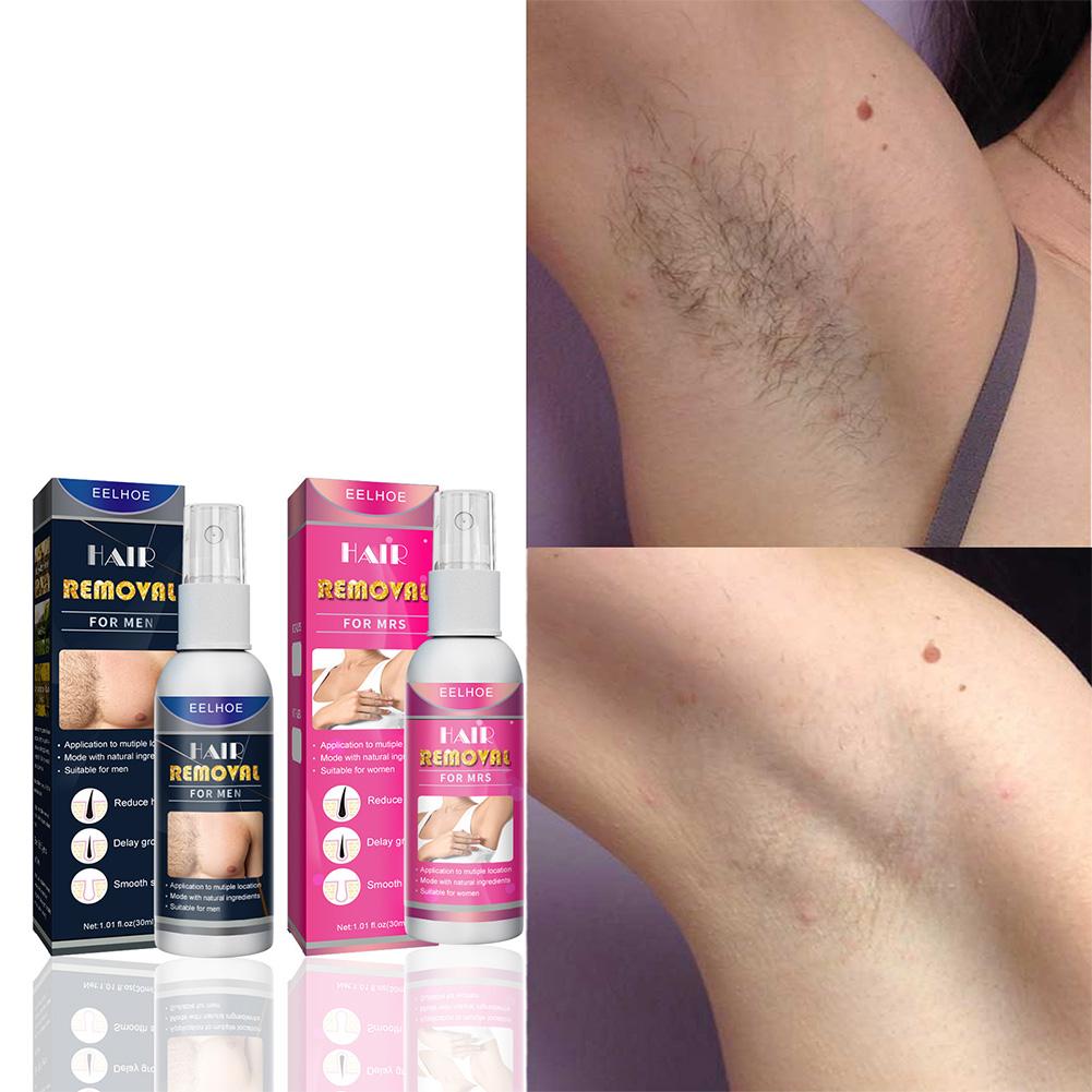 1/2PCS Super Natural Painless  – Hair Care Spray recenzja i cena