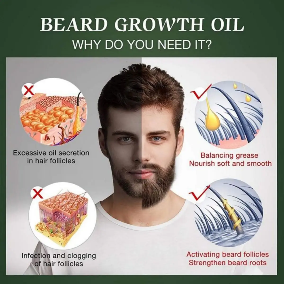 Fast Beard Growth Oil Beard Oi – Hair Care Essence Oil Spray recenzja i cena