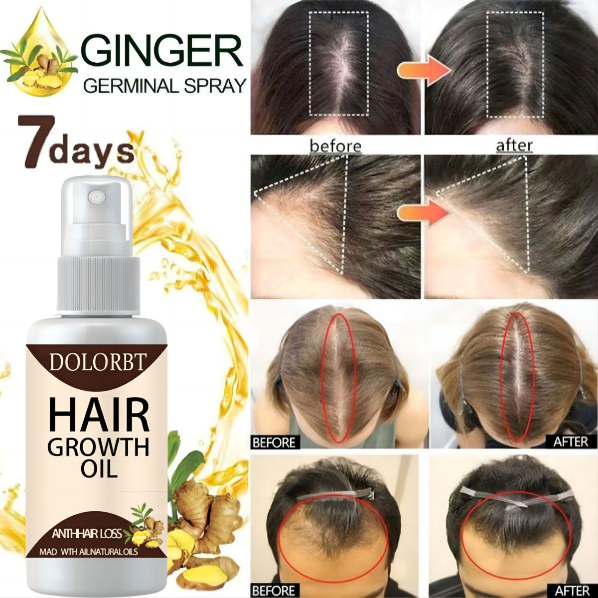 Hair Growth Essence Oil Spray  – Hair Care Herbal Products recenzja i cena