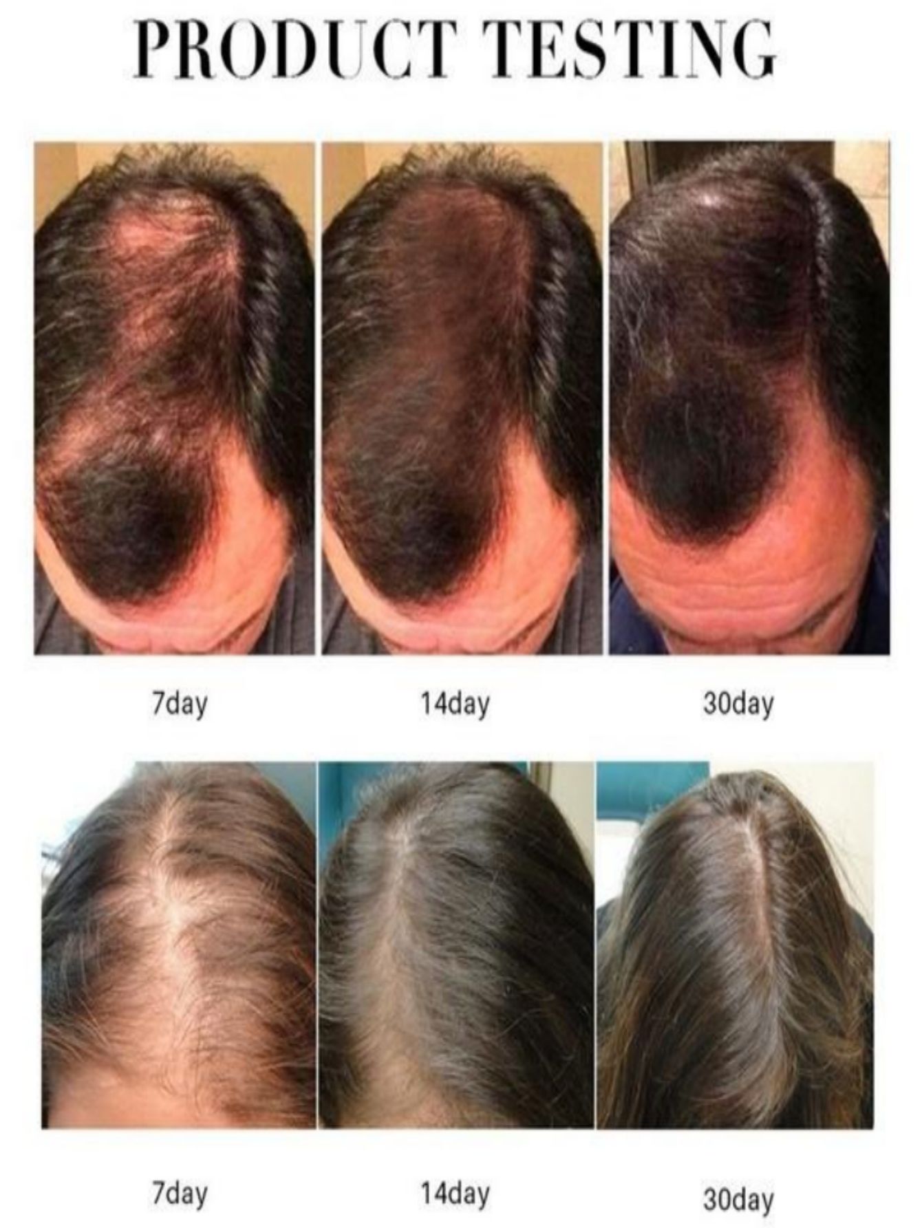 Hair Growth Essence Oil Spray  – Hair Care Herbal Products recenzja i cena