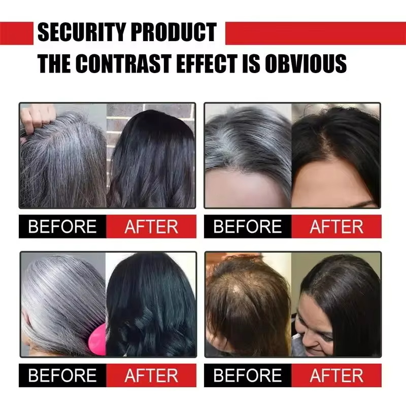 Herbal Anti-grey Hair Treatmen – Hair Care Herbal Products recenzja i cena