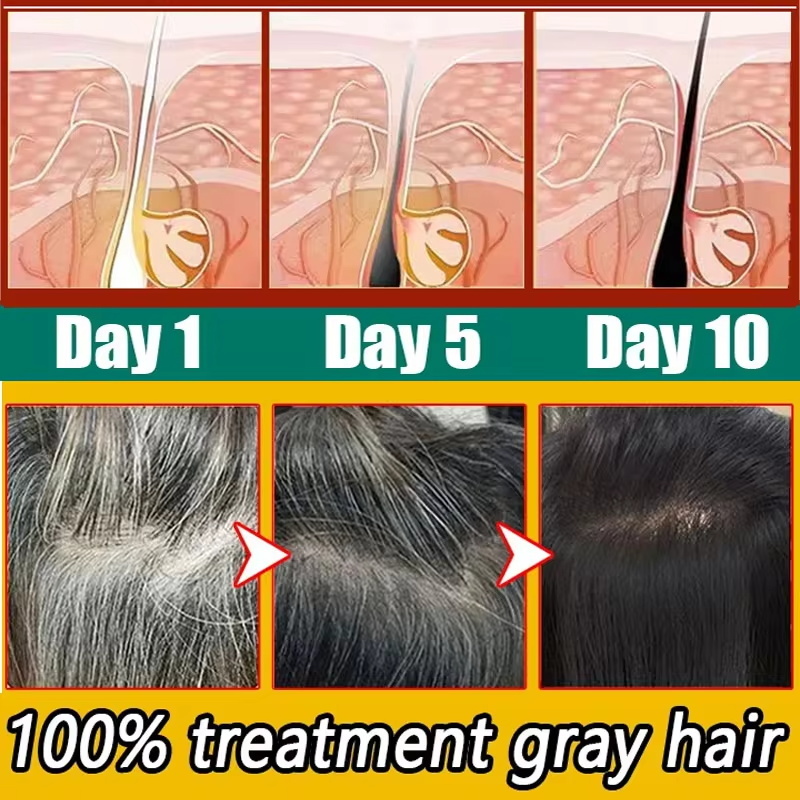 Herbal Anti-grey Hair Treatmen – Hair Care Herbal Products recenzja i cena