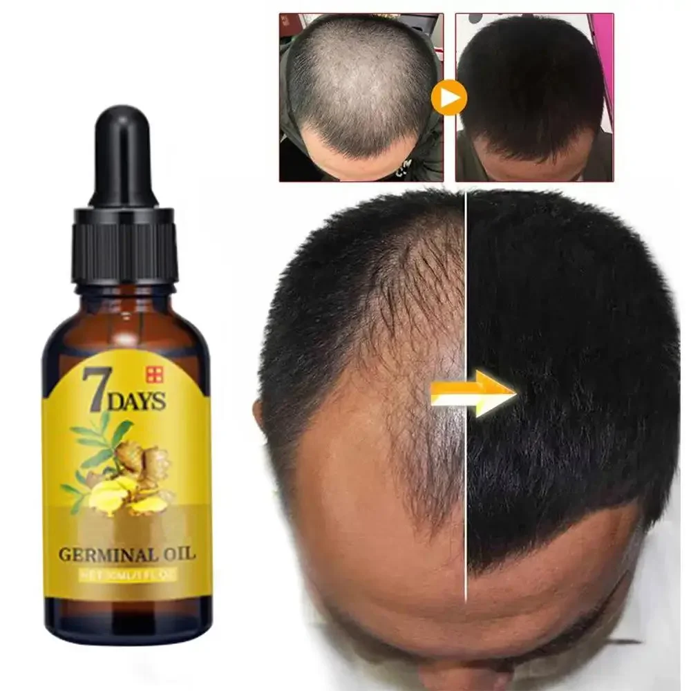 Hair Growth Ginger Fast Growin – Hair Care Essence Oil Spray recenzja i cena