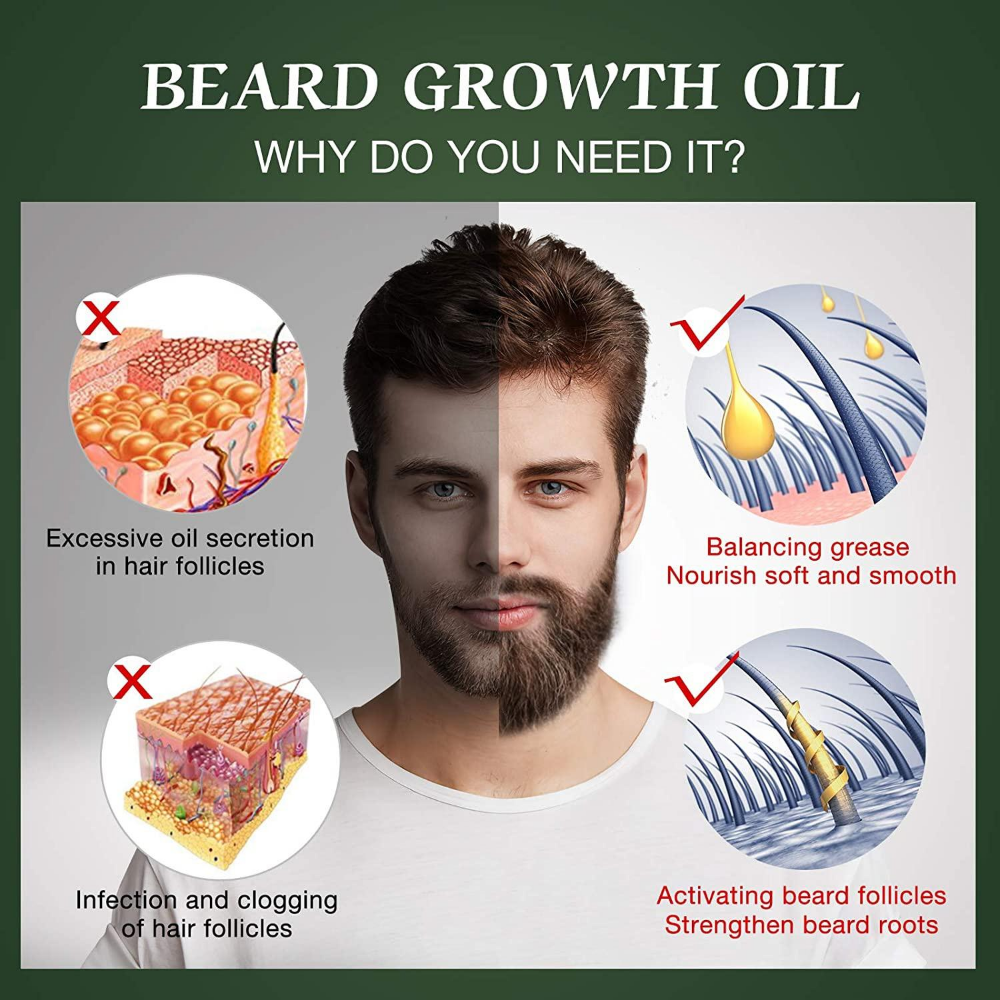 Fast Beard Growth Oil Beard Oi – Hair Care Essence Oil Spray recenzja i cena