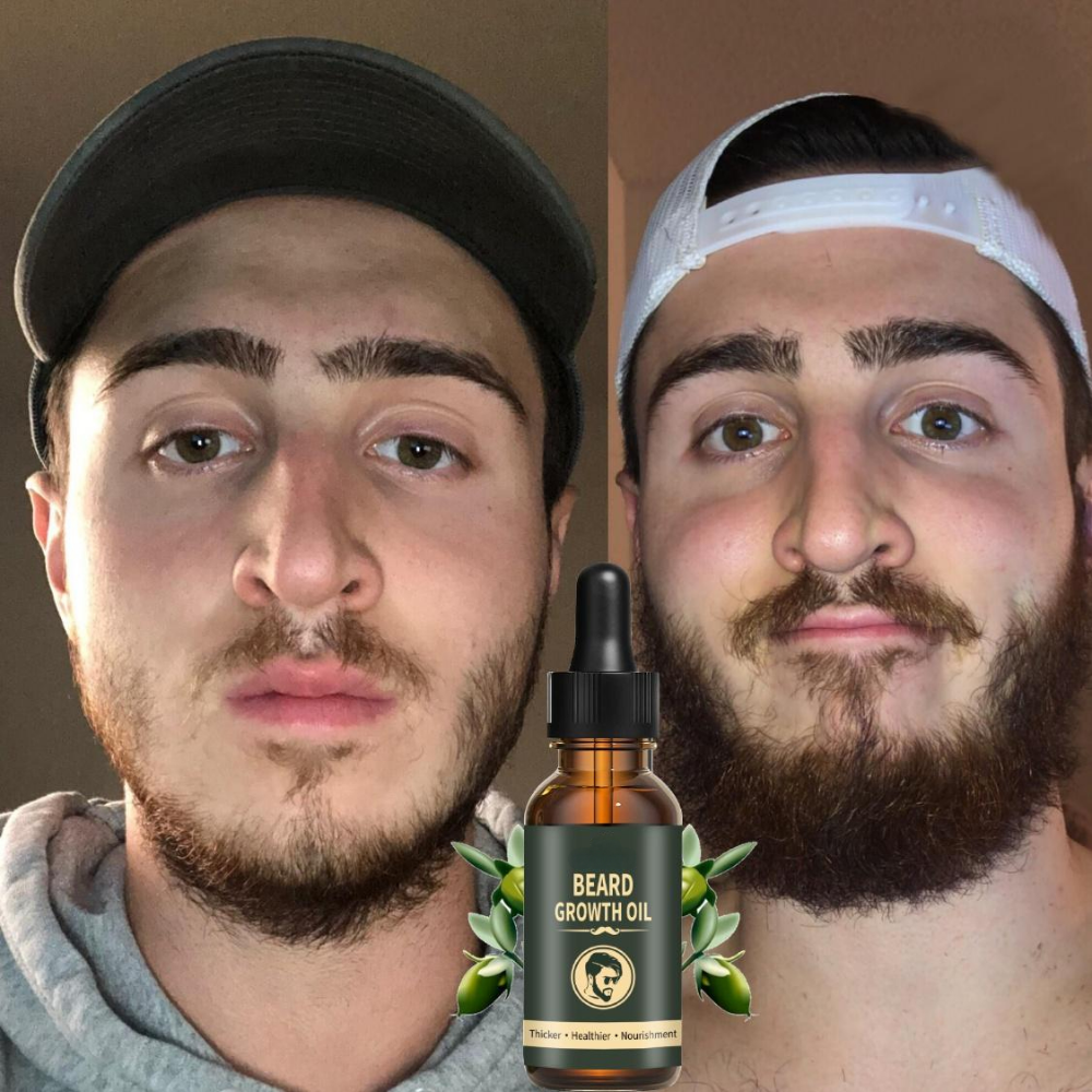 Fast Beard Growth Oil Beard Oi – Hair Care Essence Oil Spray recenzja i cena